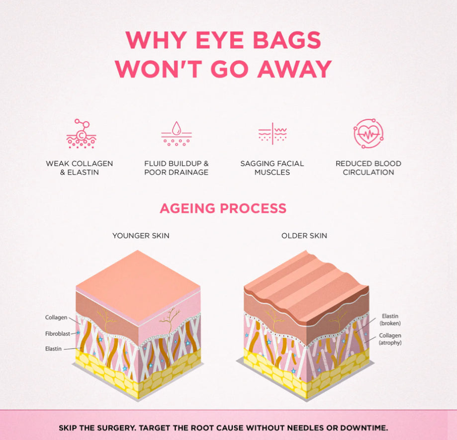 Oria® 2-in-1 Red Light Therapy + EMS to Erase Eye Bags