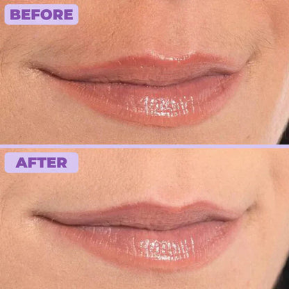 Oria Facial & Body Hair Removal Cream